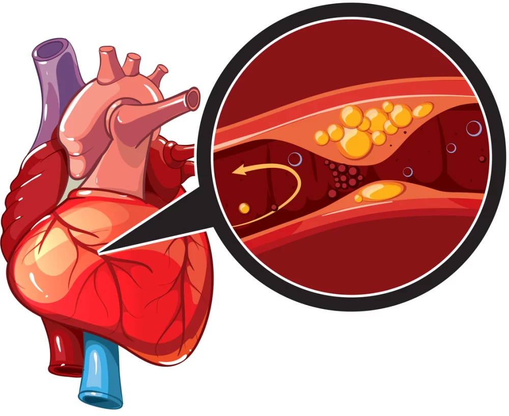 Heart Disease and the Impact of Family History: What You Need to Know