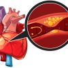 Heart Disease and the Impact of Family History: What You Need to Know
