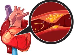 Heart Disease and the Impact of Family History: What You Need to Know