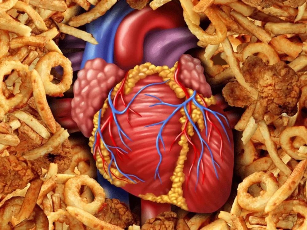 The Importance of Trans Fat Avoidance in Preventing Heart Disease