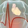 The Growing Concern of Obesity and Its Impact on Heart Disease