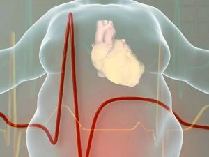 The Growing Concern of Obesity and Its Impact on Heart Disease