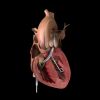 Exploring Effective Treatment Options for Heart Failure
