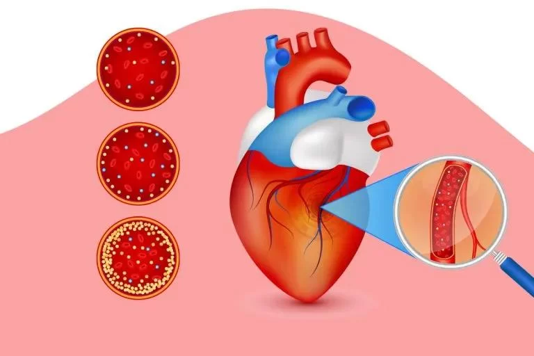 Debunking Common Myths About Heart Disease and Cholesterol in Your Diet