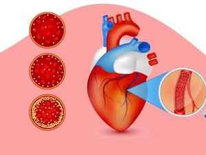 Debunking Common Myths About Heart Disease and Cholesterol in Your Diet