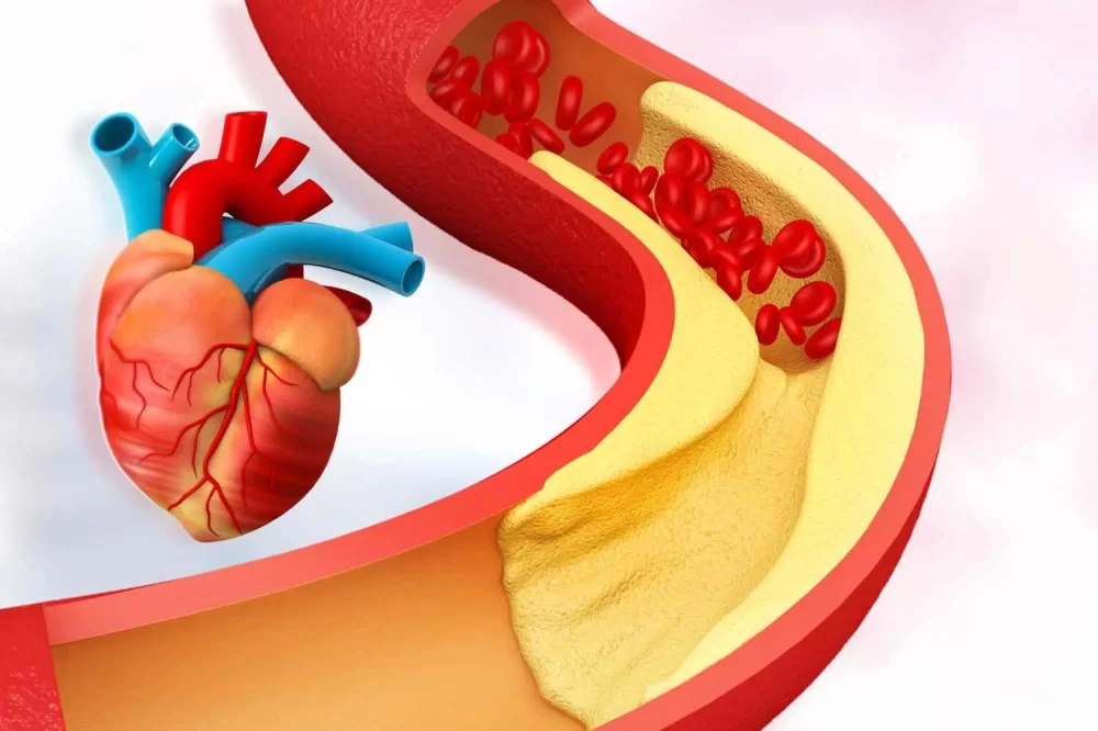 The Importance of Cholesterol Management for Heart Health