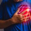 Understanding Coronary Artery Disease: Causes, Symptoms, and Prevention