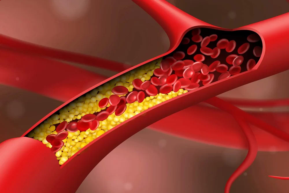 Understanding Heart Disease and Blood Thinning Medications: A Comprehensive Guide