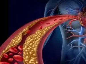 The Critical Role of Vascular Inflammation in Heart Disease Development