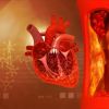 Vitamin Supplements and Their Role in Supporting Heart Disease Prevention and Cardiovascular Health