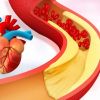 Effective Strategies on How to Reduce Cholesterol to Support Heart Disease Prevention