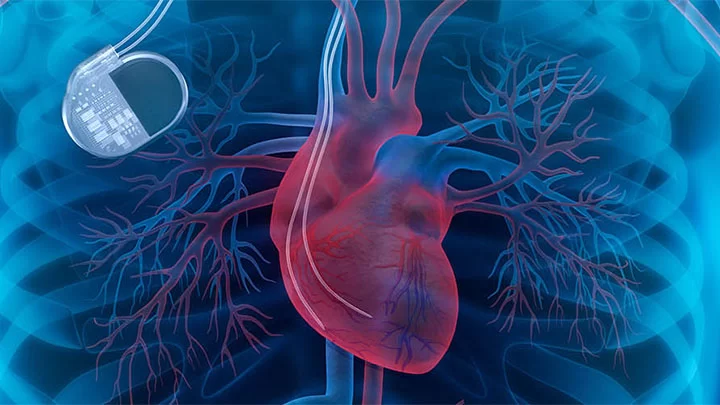 Understanding Heart Disease and the Importance of Clinical Trial Participation for Better Treatments