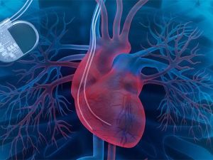 Understanding Heart Disease and the Importance of Clinical Trial Participation for Better Treatments