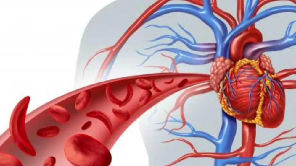 Heart Disease and Thrombosis Prevention: Essential Strategies for Better Health