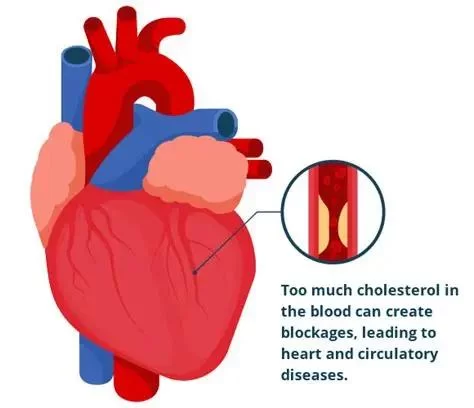 Heart Disease and Cholesterol Meters: Monitoring Your Heart Health Effectively