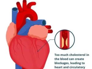 Heart Disease and Cholesterol Meters: Monitoring Your Heart Health Effectively