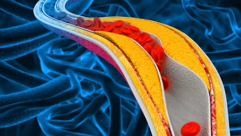 Heart Disease and Heavy Metals Risks: Understanding the Connection