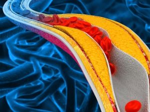 Heart Disease and Heavy Metals Risks: Understanding the Connection