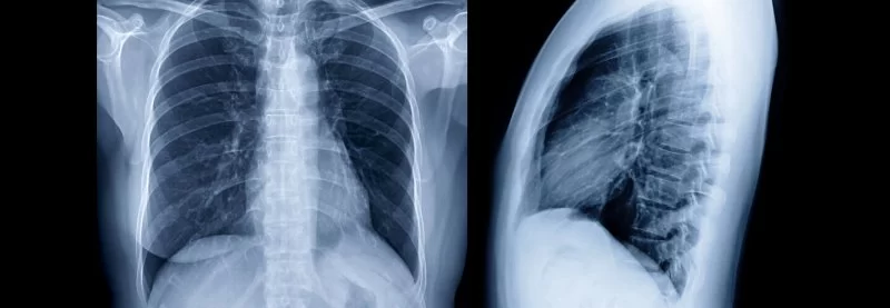 Beyond the Basics: Advanced Heart Health Screenings You Should Consider