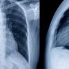 Beyond the Basics: Advanced Heart Health Screenings You Should Consider
