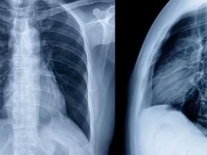 Beyond the Basics: Advanced Heart Health Screenings You Should Consider