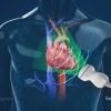 What to Expect During an Echocardiogram: A Detailed Guide