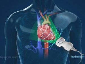 What to Expect During an Echocardiogram: A Detailed Guide