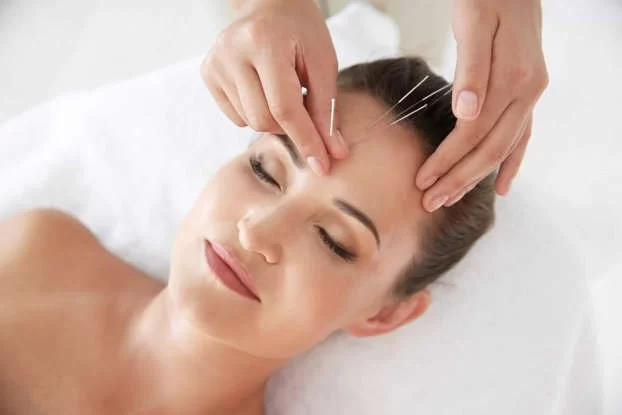 Acupuncture: An Ancient Practice for Modern Heart Health
