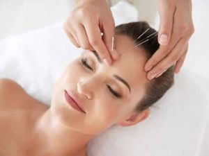 Acupuncture: An Ancient Practice for Modern Heart Health