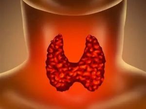 Thyroid Disorders: Their Unexpected Link to Your Heart