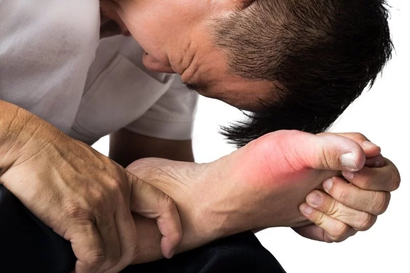 Gout: Managing Inflammation for Heart Protection