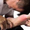 Gout: Managing Inflammation for Heart Protection