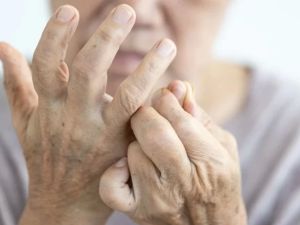 Rheumatoid Arthritis and Heart Health: Managing Systemic Inflammation for Better Wellness