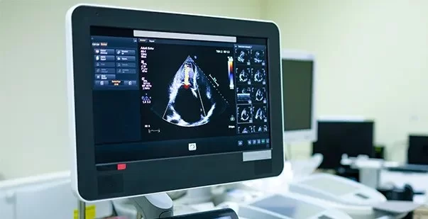 Echocardiogram Explained: What This Important Test Reveals About Your Heart