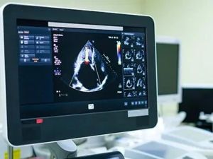 Echocardiogram Explained: What This Important Test Reveals About Your Heart