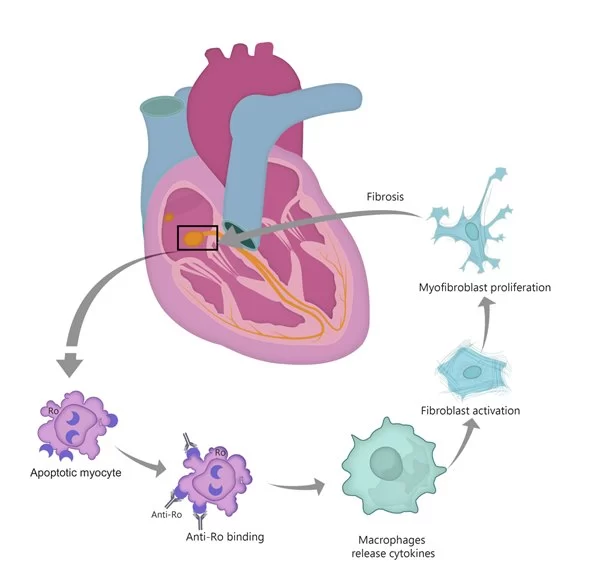 Stem Cell Applications in Regenerative Cardiology and Future Advances