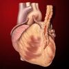 Coronary Artery Bypass Grafting (CABG): What to Expect from Bypass Surgery