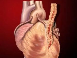 Coronary Artery Bypass Grafting (CABG): What to Expect from Bypass Surgery