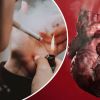 How Smoking — Even Occasional — Affects Your Heart and Blood Vessels