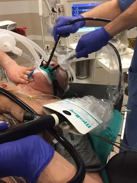 What Is a Transesophageal Echocardiogram? Everything You Need to Know