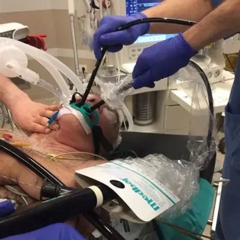 What Is a Transesophageal Echocardiogram? Everything You Need to Know