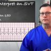 What Is Supraventricular Tachycardia (SVT)? Understanding Symptoms and Treatment